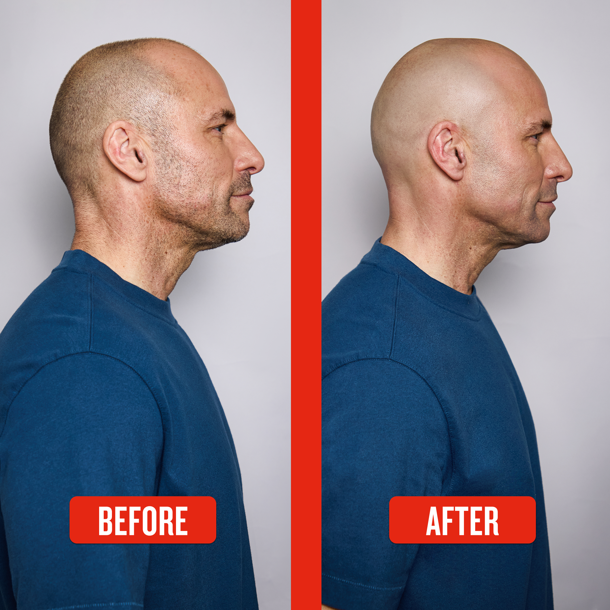 Balder™ Head & Face Shaver - Image 7